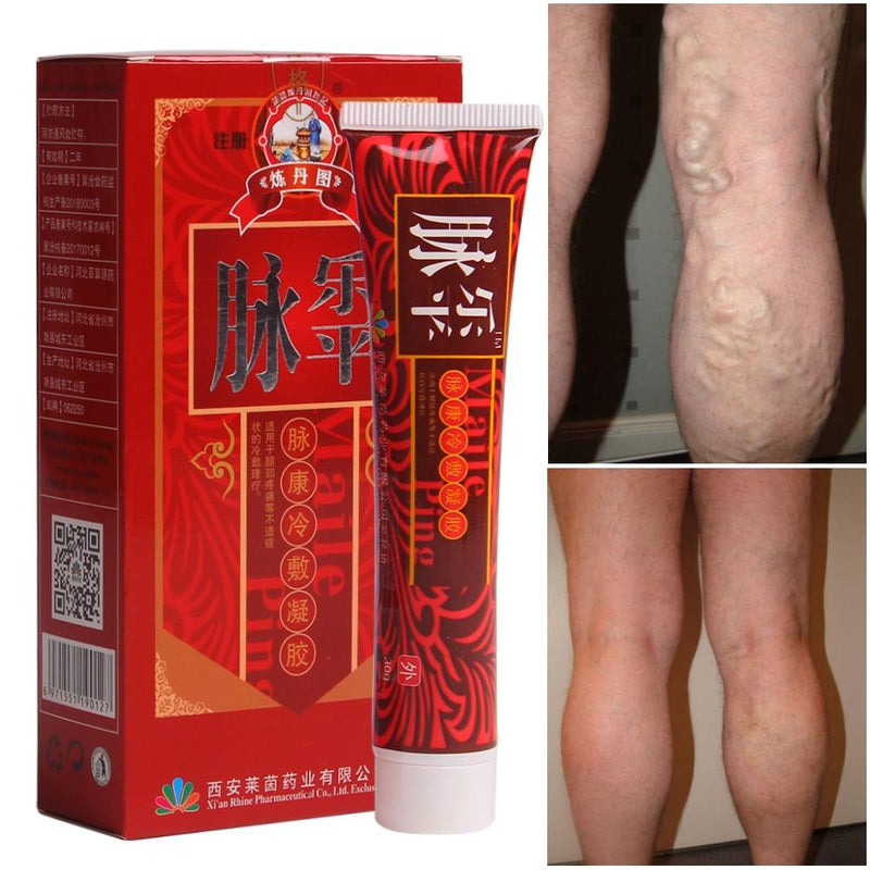 Varicose Veins Treatment Cream - MakenShop